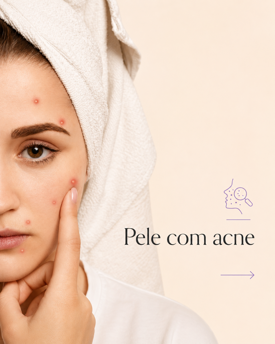 Rotina Acne - Twoone Onetwo
